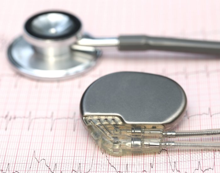 Biventricular Pacemakers – How Long Can You Live Peacefully With It?